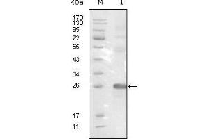 Western blot analysis using EphB3 mouse mAb against truncated EphB3-His recombinant protein. (EPH Receptor B3 anticorps  (AA 39-212))
