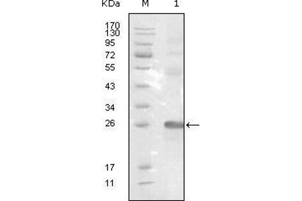 EPH Receptor B3 anticorps  (AA 39-212)