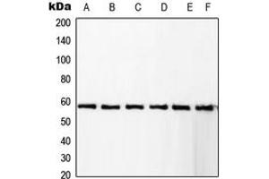 Western blot analysis of RCBTB1 expression in KNRK (A), Jurkat (B), A431 (C), HeLa (D), Raw264. (RCBTB1 anticorps  (Center))