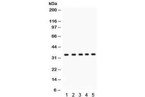 Western blot testing of 1) rat testis, 2) human 22RV1, 3) HeLa, 4) MCF7, and 5) Jurkat lysate with EBAG9 antibody. (RCAS1 anticorps  (AA 31-213))