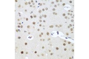 Immunohistochemistry of paraffin-embedded mouse brain using UTP14A antibody  at dilution of 1:100 (40x lens). (UTP14A anticorps  (AA 1-260))