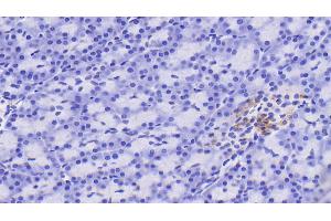 Detection of RBP4 in Human Pancreas Tissue using Polyclonal Antibody to Retinol Binding Protein 4 (RBP4)