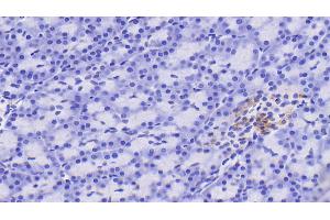 Detection of RBP4 in Human Pancreas Tissue using Polyclonal Antibody to Retinol Binding Protein 4 (RBP4) (RBP4 anticorps)