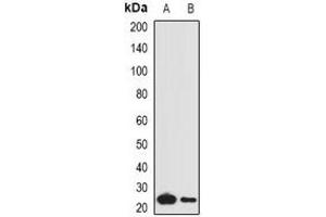 Western blot analysis of Complement C1QA expression in mouse lung (A), mouse liver (B) whole cell lysates. (C1QA anticorps)