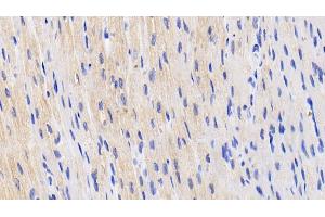 Detection of HIF2a in Human Cardiac Muscle Tissue using Polyclonal Antibody to Hypoxia Inducible Factor 2 Alpha (HIF2a) (EPAS1 anticorps  (AA 339-541))