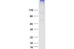 Validation with Western Blot