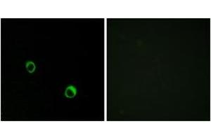 Immunofluorescence analysis of MCF7 cells, using CAR14 Antibody. (CA14 anticorps  (AA 291-340))