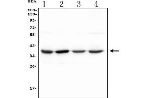 Western blot analysis of SFRP2 using anti-SFRP2 antibody (ABIN7603133).