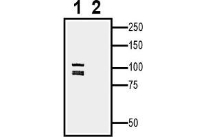 1. (EPH Receptor A5 anticorps  (Extracellular, N-Term))