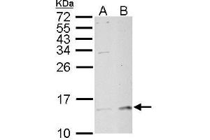 WB Image MP1 antibody detects MP1 protein by Western blot analysis. (MAPKSP1 anticorps)