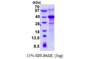 RWD Domain Containing 1 (RWDD1) (AA 1-243) protein (His tag)
