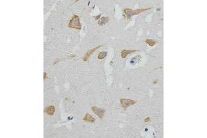(ABIN388564 and ABIN2849716) staining GABAR in human brain tissue sections by Immunohistochemistry (IHC-P - paraformaldehyde-fixed, paraffin-embedded sections). (GABARAP anticorps  (AA 1-30))