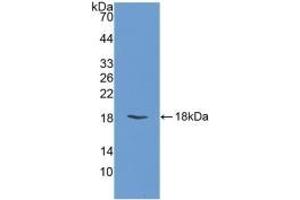 Detection of Recombinant FABP3, Bovine using Polyclonal Antibody to Heart-type Fatty Acid Binding Protein (H-FABP) (FABP3 anticorps  (AA 1-133))