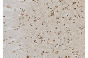 ABIN6276553 at 1/100 staining Human brain tissue by IHC-P. (DUSP6 anticorps  (Internal Region))