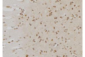 ABIN6276553 at 1/100 staining Human brain tissue by IHC-P. (DUSP6 anticorps  (Internal Region))