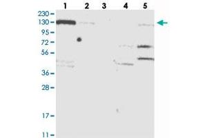 Western blot analysis of Lane 1: RT-4, Lane 2: U-251 MG, Lane 3: Human Plasma, Lane 4: Liver, Lane 5: Tonsil with NCOA7 polyclonal antibody  at 1:250-1:500 dilution. (NCOA7 anticorps)