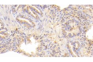 Detection of CD40L in Human Lung Tissue using Polyclonal Antibody to Cluster Of Differentiation 40 Ligand (CD40L) (CD40 Ligand anticorps  (AA 1-261))