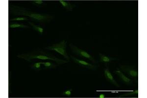 Immunofluorescence of monoclonal antibody to SMAD9 on HeLa cell.