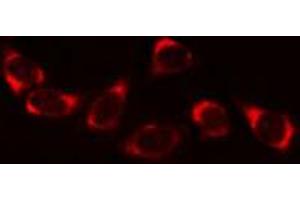 ABIN6269268 staining A549 cells by IF/ICC. (PLA2G4A anticorps  (Internal Region))