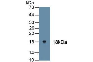 Detection of Recombinant TP63, Human using Polyclonal Antibody to Tumor Protein P63 (TP63) (p63 anticorps)