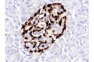 VIP was detected in paraffin-embedded sections of human pancreatic cancer tissues using rabbit anti- VIP Antigen Affinity purified polyclonal antibody (Catalog # ) at 1 ?