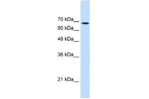WB Suggested Anti-TGM2 Antibody Titration:  0. (Transglutaminase 2 anticorps  (Middle Region))