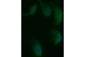 Image no. 2 for anti-Synaptophysin (SYP) antibody (ABIN1501259)