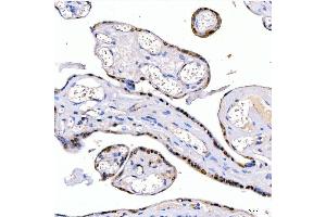 IHC analysis of LIN28B using anti-LIN28B antibody (ABIN7600743). (LIN28B anticorps  (AA 23-249))