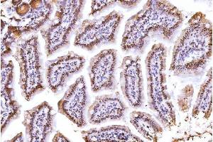 IHC analysis of PC4/SUB1 using anti-PC4/SUB1 antibody (ABIN7602184).