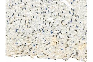 Phospho-TMS1/ASC (Ser195) Antibody at 1/100 staining Rat heart tissue by IHC-P. (PYCARD anticorps  (pSer195))