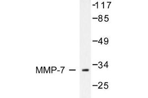 Image no. 1 for anti-Matrix Metallopeptidase 7 (Matrilysin, Uterine) (MMP7) antibody (ABIN265532) (MMP7 anticorps)