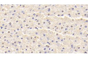 Detection of SOD1 in Rabbit Liver Tissue using Polyclonal Antibody to Superoxide Dismutase 1 (SOD1)