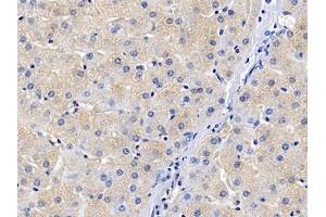 Detection of SLC in Human Liver Tissue using Polyclonal Antibody to Secondary Lymphoid Tissue Chemokine (SLC)