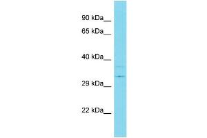 Host:  Rabbit  Target Name:  USP39  Sample Type:  Breast Tumor lysates  Antibody Dilution:  1. (USP39 anticorps  (C-Term))