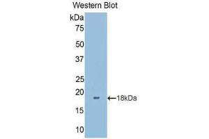 Western Blotting (WB) image for anti-Lectin, Galactoside-Binding, Soluble, 9B (LGALS9B) (AA 228-355) antibody (ABIN1858956) (LGALS9B anticorps  (AA 228-355))
