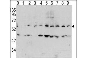 Western blot analysis of Phospho-MYC-T58 Antibody in human T activated Hela cell line lysates. (c-MYC anticorps  (pThr58))