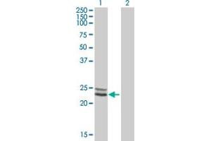 Western Blot analysis of NDUFV2 expression in transfected 293T cell line by NDUFV2 MaxPab polyclonal antibody. (NDUFV2 anticorps  (AA 1-249))