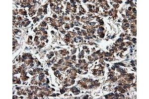 Image no. 3 for anti-Fumarylacetoacetate Hydrolase Domain Containing 2A (FAHD2A) antibody (ABIN1498184) (FAHD2A anticorps)