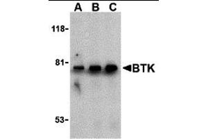 Western Blotting (WB) image for anti-Bruton Agammaglobulinemia tyrosine Kinase (BTK) (N-Term) antibody (ABIN1031284) (BTK anticorps  (N-Term))