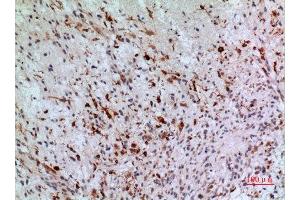 Immunohistochemistry (IHC) analysis of paraffin-embedded Human Brain, antibody was diluted at 1:100.