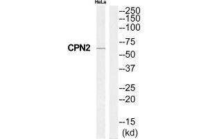 Western Blotting (WB) image for anti-Carboxypeptidase N Subunit 2 (CPN2) (C-Term) antibody (ABIN1851028)