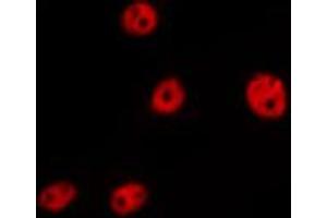 ABIN6267445 staining MCF7 by IF/ICC.