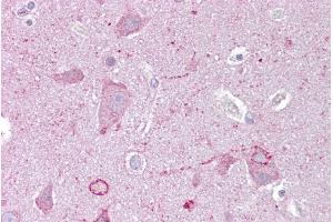 Immunohistochemistry with Brain, cortex tissue at an antibody concentration of 5µg/ml using anti-EGR3 antibody (ARP34196_P050)