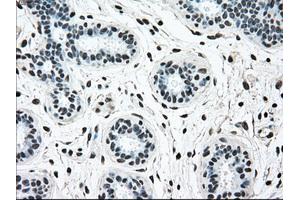 Immunohistochemical staining of paraffin-embedded breast tissue using anti-BRAF mouse monoclonal antibody. (BRAF anticorps)