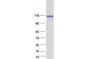 Validation with Western Blot