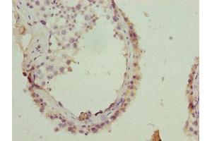 anti-Golgi SNAP Receptor Complex Member 2 (GOSR2) (AA 1-190) antibody