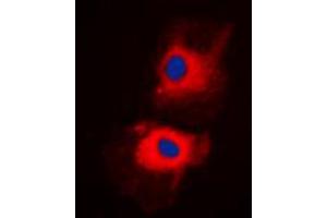 Immunofluorescent analysis of HGS staining in H1299 cells. (HGS anticorps  (Center))