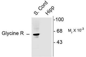 Image no. 1 for anti-Glycine Receptor, alpha 1 (GLRA1) (N-Term) antibody (ABIN372657) (GLRA1 anticorps  (N-Term))