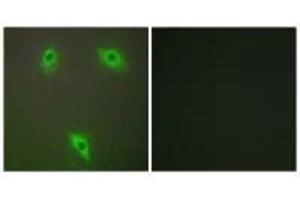 Immunofluorescence analysis of A549 cells, using KLHL3 antibody.
