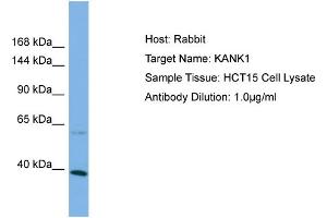 Host: Rabbit Target Name: KANK1 Sample Type: HCT15 Whole Cell lysates Antibody Dilution: 1. (ANKRD15 anticorps  (C-Term))